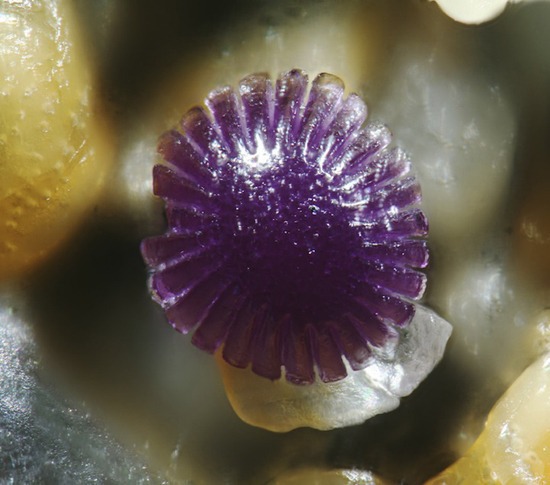 granos arena microscópico